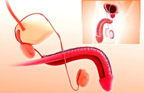 Deformazione del pene e ingrandimento del glande